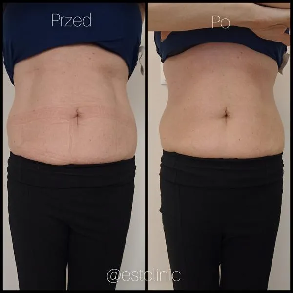 Bezpieczne środki czyszczące